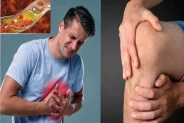 உங்க கால்களில் இந்த அறிகுறி இருந்தால் அலட்சியமா விடாதீங்க: இந்த பிர்ச்சனையாக கூட இருக்கலாம்