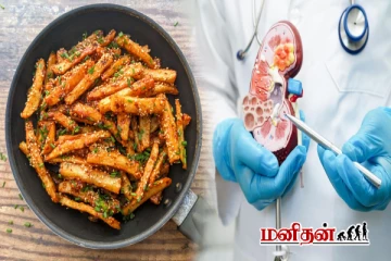 சில்லி பொட்டேடோ சாப்பிட்டால் சிறுநீரக பாதிப்பு வருமா? முழு விபரம் இதோ