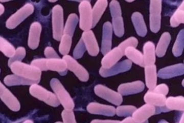 නව ලිස්ටීරියා වෛරසය මෙරටටත් ඇවිත්ද... වසංගත විද්‍යා ආයතනයෙන් පැහැදිලි කිරීමක්..