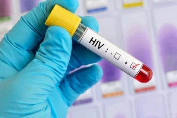 எயிட்ஸ் பரவல் புதிய உச்சம் ; மக்களுக்கு வெளியான எச்சரிக்கை