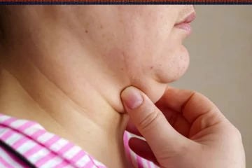 இரட்டை கன்னம் உங்கள் முகத்தை அசிங்கமாக்குகின்றதா? இந்த பயிற்சிகளை மறக்காமல் செய்து வாங்க போதும்!