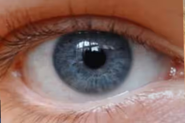 மொபைல் லைட்டிலேயே கேன்சரை கண்டுபிடித்த தாய் | Mother Identified Eye Cancer Smartphone Flashlight