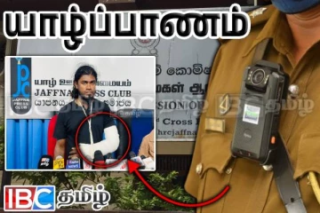 யாழில் இளைஞரின் கையை முறித்த காவல்துறையினர் : பறந்த அதிரடி அழைப்பு