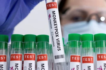 சுவீடனில் குரங்கம்மை நோயுடன் முதலாவது நபர் அடையாளம்!