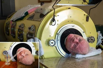 272 கிலோ இயந்திர நுரையீரலுக்குள் வாழ்ந்த நபர் மரணம் - 70 ஆண்டு கால வாழ்கை போராட்டம்!