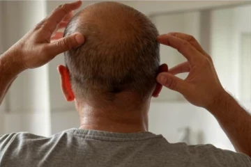 முடி உதிர்வதை தடுக்க சிகிச்சை எடுத்த 65 பேர் மருத்துவமனையில் அனுமதி