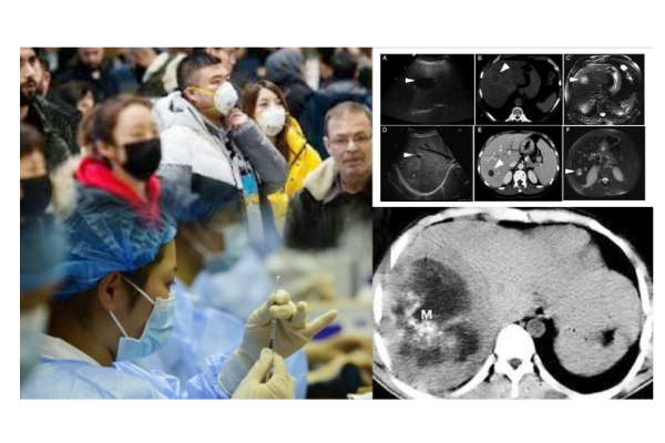 கொரோனாவை அடுத்து கனடாவை உலுக்கி எடுக்கும் அபூர்வ வகை உயிர்க்கொல்லி நோய்! | World