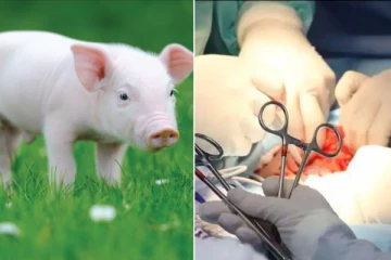 மனிதருக்கு பொருத்தப்பட்ட பன்றியின் சிறுநீரகம் - அதிர்ச்சி சம்பவம்