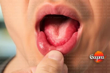 භයානක රෝගයක් හිස ඔසවයි - මේ රෝග ලක්ෂණ ඇත්නම් දැන්ම පරික්ෂා කරගන්න