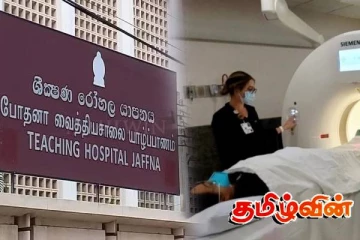 வழமைக்கு திரும்பிய யாழ்.போதனா வைத்தியசாலையின் CT ஸ்கேன் பரிசோதனைகள்!