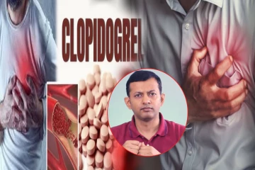 இதய நோய்களுக்கான clopidogrel மருந்து குறித்து அதிர்ச்சி தகவல்! விளக்கும் மருத்துவர்