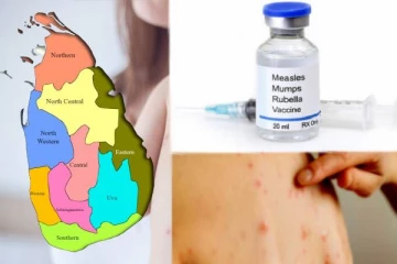 தட்டம்மை தடுப்பூசி மேலதிக டோஸ்: சனிக்கிழமை வழங்கத் தீர்மானம்