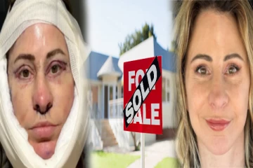 பிளாஸ்டிக் சர்ஜரிக்காக ரூ.11 லட்சத்திற்கு வீட்டையே விற்ற 50வயது பெண் - இப்போது எங்கு வசிக்கிறார் தெரியுமா?