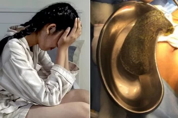 சிறுமியின் வயிற்றுக்குள் இருந்த அந்த ஒரு பொருள்! பேரதிர்ச்சியில் மருத்துவர்கள்