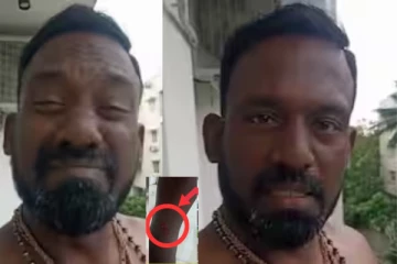 மிக்ஜாம் புயல்...வெள்ளத்தில் காயமடைந்த ரோபோ சங்கர்..!!