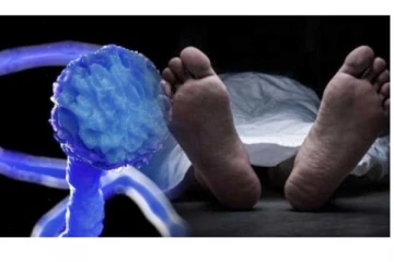 பெரம்பலூரில் கருப்பு பூஞ்சை நோயால் 2 பேர் பலி!