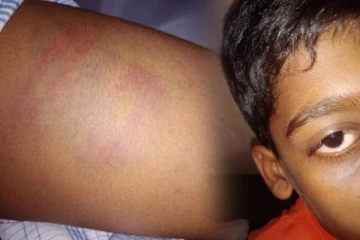 யாழில் பிரபல பாடசாலையொன்றில் ஆசிரியரால் மாணவன் தாக்கப்பட்டு வைத்தியசாலையில் அனுமதி