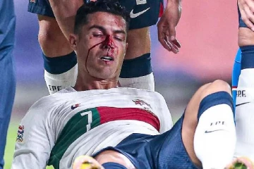 ரொனால்டோ முகத்தில் கொட்டிய ரத்தம்! அதிர்ச்சியில் உறைந்த ரசிகர்கள்.. வைரலாகும் வீடியோ