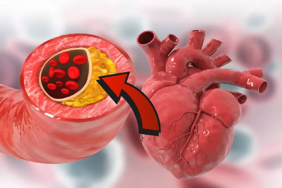 கெட்ட கொழுப்பை விரட்டியடிக்கும் உணவுகள் | Foods That Reduce Bad Cholesterol கெட்ட கொழுப்பை விரட்டியடிக்கும் உணவுகள் | Foods That Reduce Bad Cholesterol