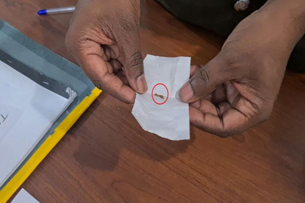 பாணில் கண்டுபிடிக்கப்பட்ட மனிதனின் கைவிரல் தோல் | Piece Of Skin From A Wound On A Slice Of Bread