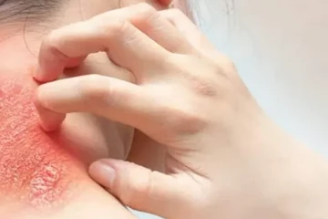 வேகமாக பரவும் தொற்று ; இலங்கை மக்களுக்கு எச்சரிக்கை!