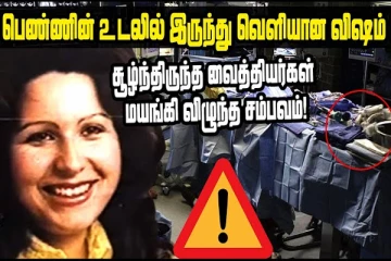 பெண்ணின் உடலில் இருந்து வெளியான விஷம் ! சூழ்ந்திருந்த வைத்தியர்கள் மயங்கி விழுந்த சம்பவம்!