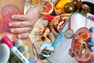 உடம்பில் யூரிக் ஆசிட் அதிகரித்தால் வரும் பேராபத்து