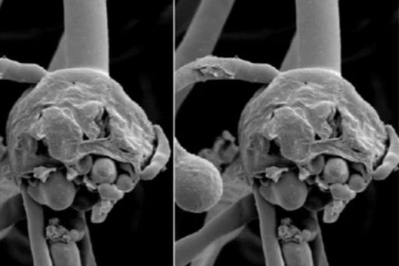 தமிழகத்தில் கருப்பு பூஞ்ஞை நோய் தொற்று நோயாக அறிவிப்பு