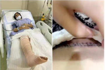 விபத்தில் சிக்கிய நடிகை யாஷிகாவின் நிலை என்ன? அதிர்ச்சியில் ரசிகர்கள்..