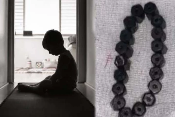 வயிறுவலியால் துடித்த 4 வயது சிறுவன்! பரிசோதித்த மருத்துவருக்கு கிடைத்த பேரதிர்ச்சி