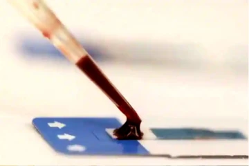 புற்றுநோயை முன்கூட்டியே கண்டறியும் ஒற்றை பரிசோதனை! விஞ்ஞானிகள் மகிழ்ச்சி தகவல்