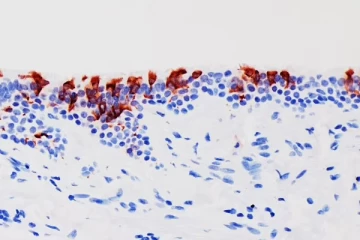 Omicron குறித்து பிரித்தானியா கூறுவது உண்மையா அல்லது தென்னாப்பிரிக்கா கூறுவது உண்மையா?