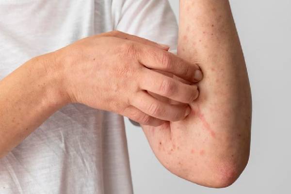 நீரிழிவு நோயின் எச்சரிக்கை அறிகுறிகள் என்னென்ன தெரியுமா? அலட்சியப்படுத்தினால் ஆபத்து! | What Are Diabetes Warning Signs On Your Skin நீரிழிவு நோயின் எச்சரிக்கை அறிகுறிகள் என்னென்ன தெரியுமா? அலட்சியப்படுத்தினால் ஆபத்து! | What Are Diabetes Warning Signs On Your Skin