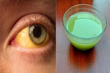 மஞ்சள் காமாலை நோயை விரட்டியடிக்கும் கீழாநெல்லி ஜீஸ்.. தினமும் குடிக்கலாமா?