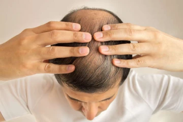 ஆண்களே! வழுக்கை தலையால் அதிகம் கவலைப்படுகிறீர்களா? இனி இதை பண்ணுங்க