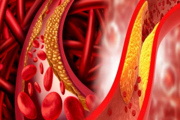 ஒரே மாதத்தில் கொலஸ்ட்ரால் குறையணுமா? காலையில் இதை மட்டும் சாப்பிடுங்க!