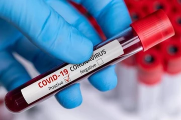 முல்லைத்தீவில் மதகுருமார் ஒருவருக்கு கோவிட் தொற்று