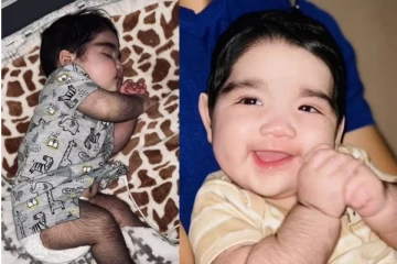 குட்டி கொரில்லாவாக மாறிய 4 மாத குழந்தை! மருந்தின் பக்கவிளைவால் நேர்ந்த கொடூரம்.. கண்கலங்கும் பெற்றோர்கள்