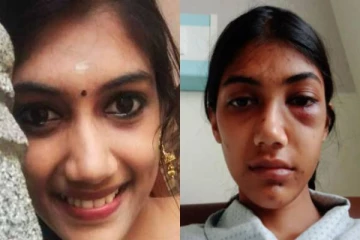 மாமியாரின் தகாத செயல்.. கண்டித்த மருமகளுக்கு நேர்ந்த கொடுமை; அதிர்ச்சி சம்பவம்