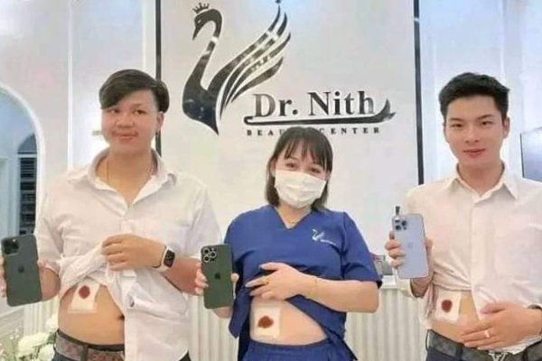 Iphone 14 மோகத்தால் சிறுநீரகத்தை இழந்த மூவர்! | Three People Lost Their Kidneys Due To Iphone 14