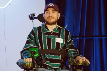 மூளையில் பொருத்தப்பட்ட எலான் மஸ்க் நிறுவன சிப் - நினைப்பதன் மூலம் செயல்களை செய்யும் நபர்