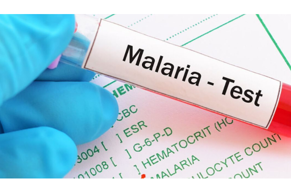 வெளிநாடுகளில் இருந்து நாடு திரும்பும் இலங்கையர்களால் அதிகரிக்கும் ஆபத்து - விடுக்கப்பட்டுள்ள எச்சரிக்கை | Maleriya Disese In Sri Lanka வெளிநாடுகளில் இருந்து நாடு திரும்பும் இலங்கையர்களால் அதிகரிக்கும் ஆபத்து - விடுக்கப்பட்டுள்ள எச்சரிக்கை | Maleriya Disese In Sri Lanka