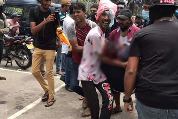காயமடைந்தோர் எண்ணிக்கை அதிகரிப்பு; இருவர் கவலைக்கிடம்! | An Increase In The Number Of Casualties