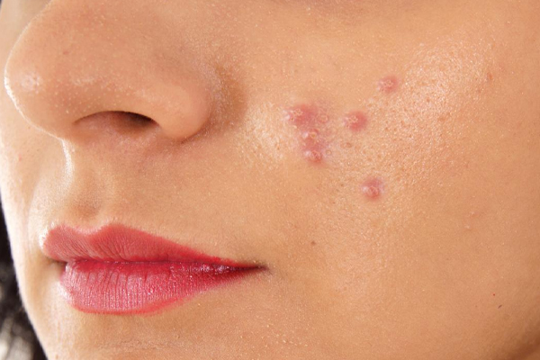 சரும பராமரிப்பில் முக்கிய பங்கு வகிக்கும் உணவுப் பொருள் | Food Plays An Important Role In Skin Care