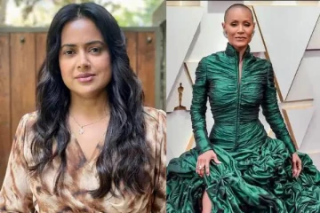 எனக்கும் அவரைப்போல அலோபேசியா நோய் இருந்தது.. மனம் திறந்த நடிகை!