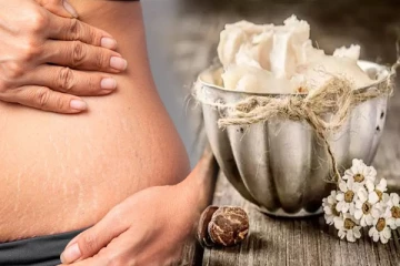 கர்ப்ப கால தழும்புகளை போக்கனுமா? அப்போ கோக்கோ பட்டர் தான் தீர்வு