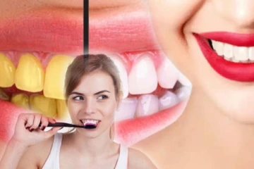 பற்களின் மஞ்சள் கறை சிரமப்பட வைக்கிறதா? வெண்மையாக மாற்ற இதோ எளிய முறை