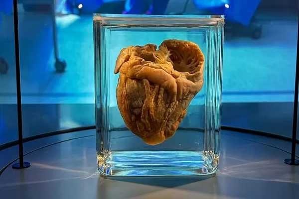 women-sees-her-own-heart-and-shares-pictures