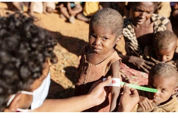 கொடூர பஞ்சம்? வெட்டுக்கிளி பூச்சிகளை சாப்பிட்டு வாழும் மடகாஸ்கர் மக்கள் - நெஞ்சை கனக்கும் புகைப்படம் | World Viral News