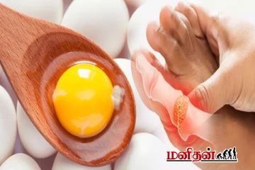 முட்டையின் மஞ்சள் கருவை யாரெல்லாம் சாப்பிட கூடாது?